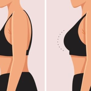 Breast Enlargement