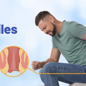 Piles